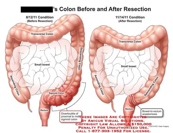 dotolo colonic machine usa